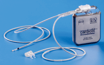 Image: The CardioFit system (Photo courtesy of BioControl Medical).